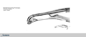 American Pattern Molar Extracting Dental Forceps - SURGINS